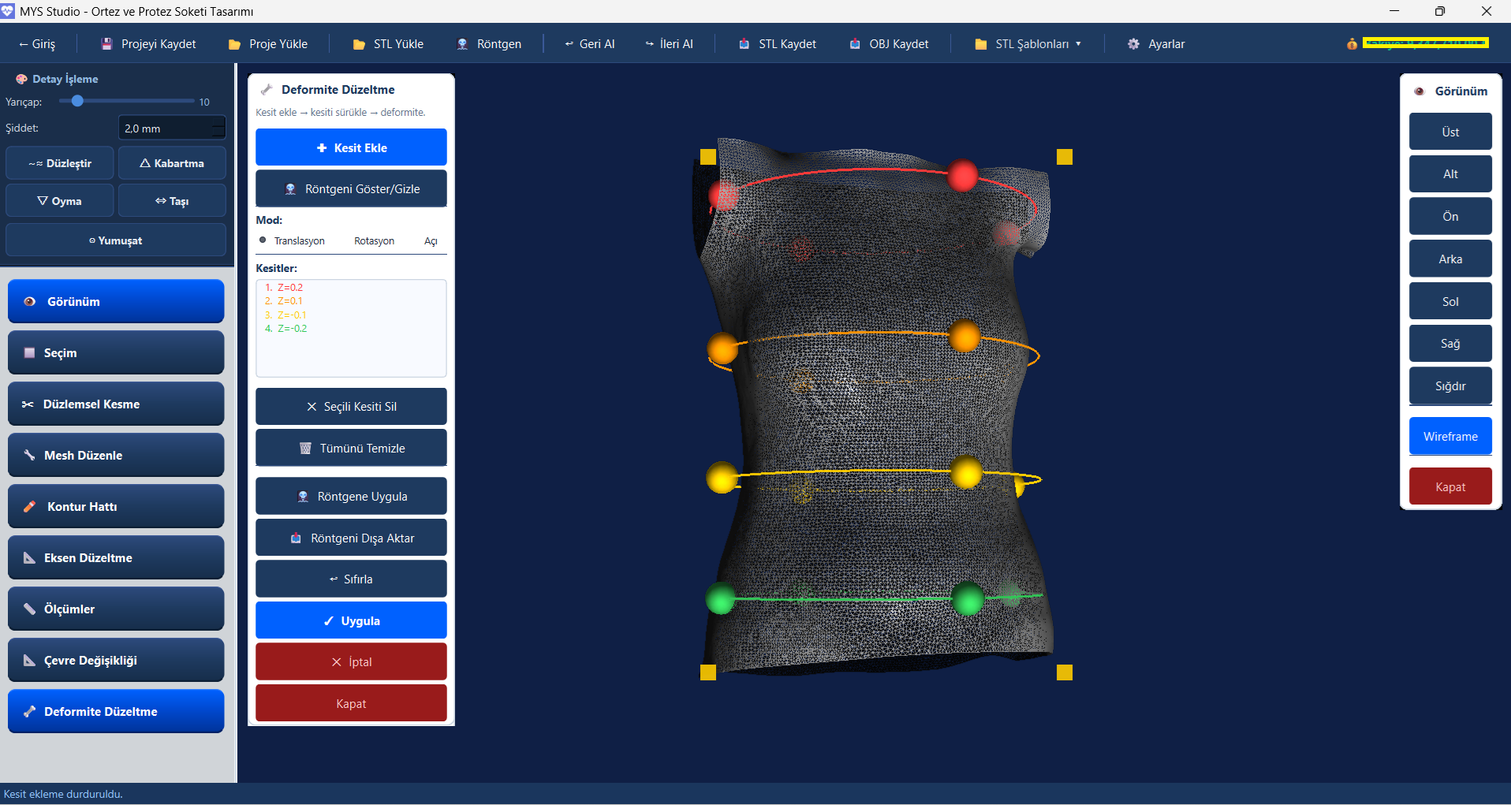 MYS Studio Ortez ve Protez Tasarım Modülü ekran görüntüsü
